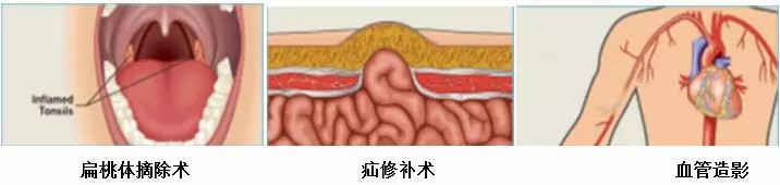 洁净服特性及测试的标准